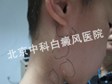 ͯ粡ʲô