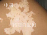 пưҽԺ