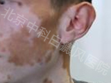 пưҽԺ